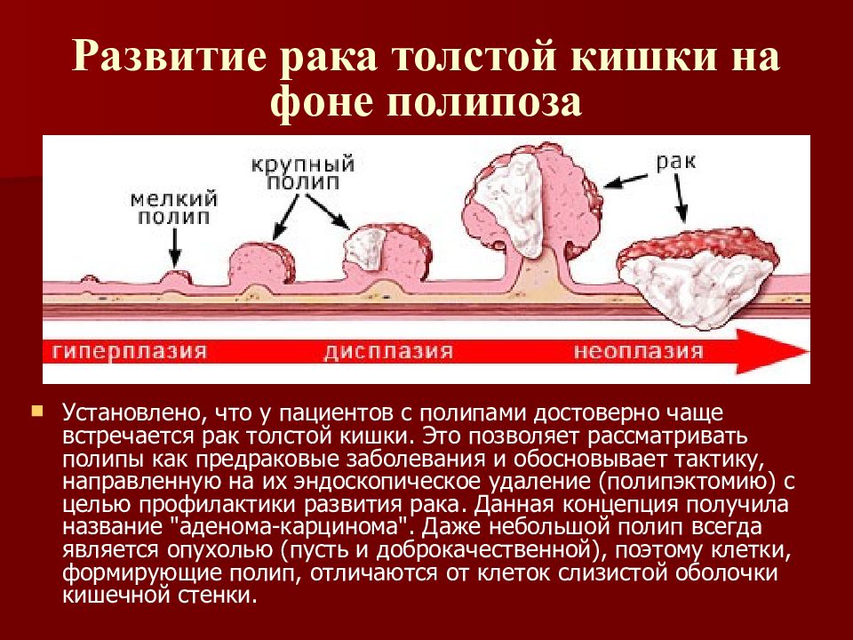 Полипэктомия Толстой Кишки Диета