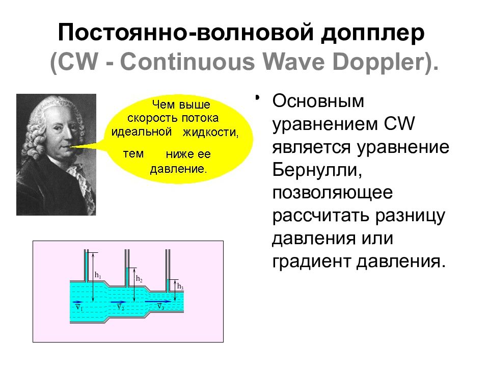 Постоянно-волновой допплер (CW - Continuous Wave Doppler).