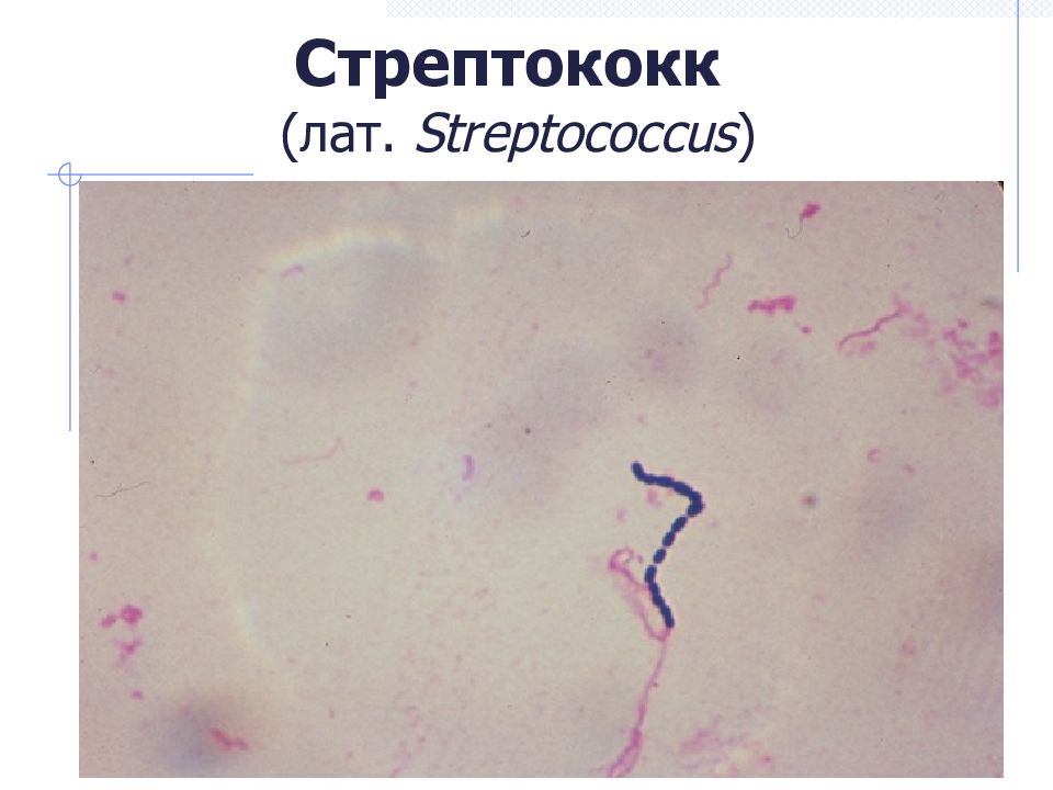 Стрептококк   ( лат.  Streptococcus )