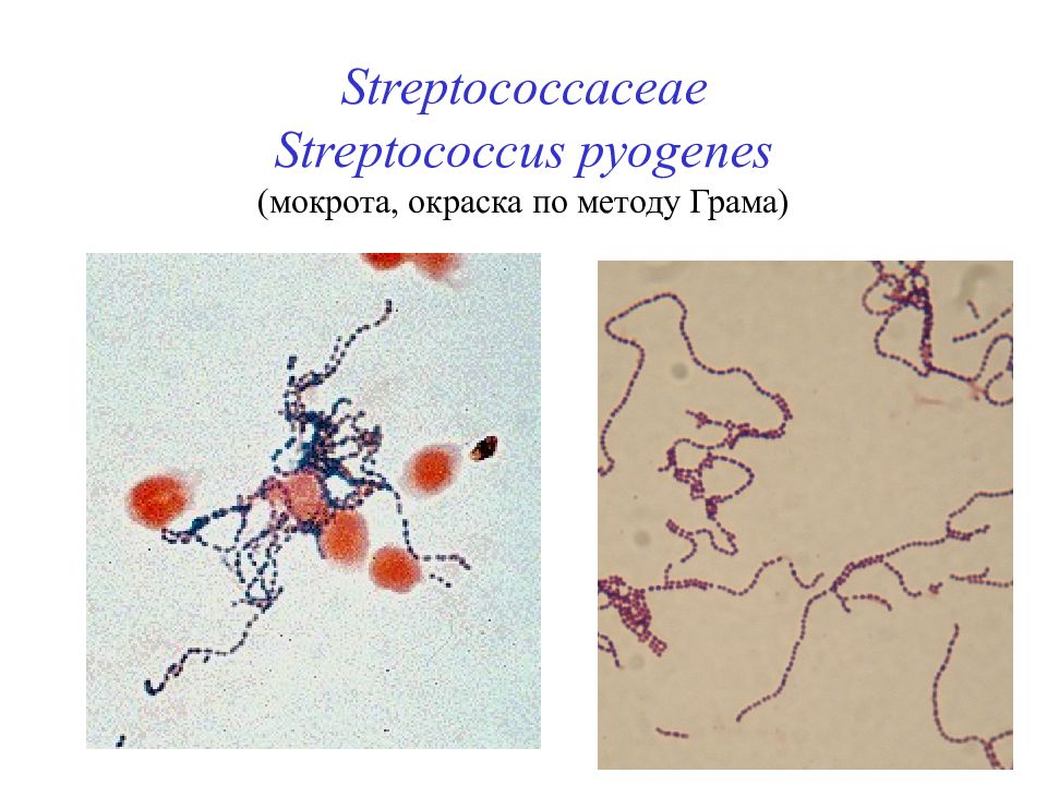 Streptococcaceae Streptococcus pyogenes ( мокрота, окраска по методу Грама)...