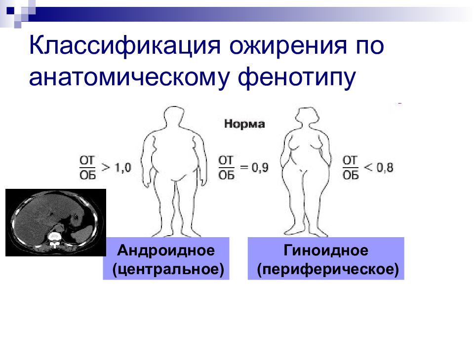 Классификация ожирения по анатомическому фенотипу