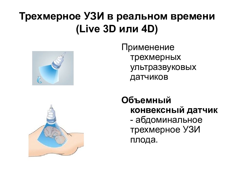Трехмерное УЗИ в реальном времени (Live 3D или 4D)