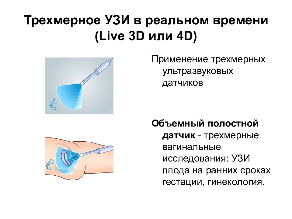 Трехмерное УЗИ в реальном времени (Live 3D или 4D)