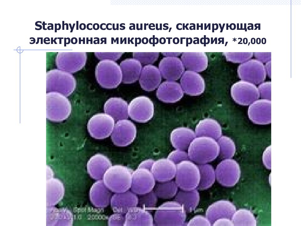 Staphylococcus aureus, сканирующая электронная микрофотография, *20,000