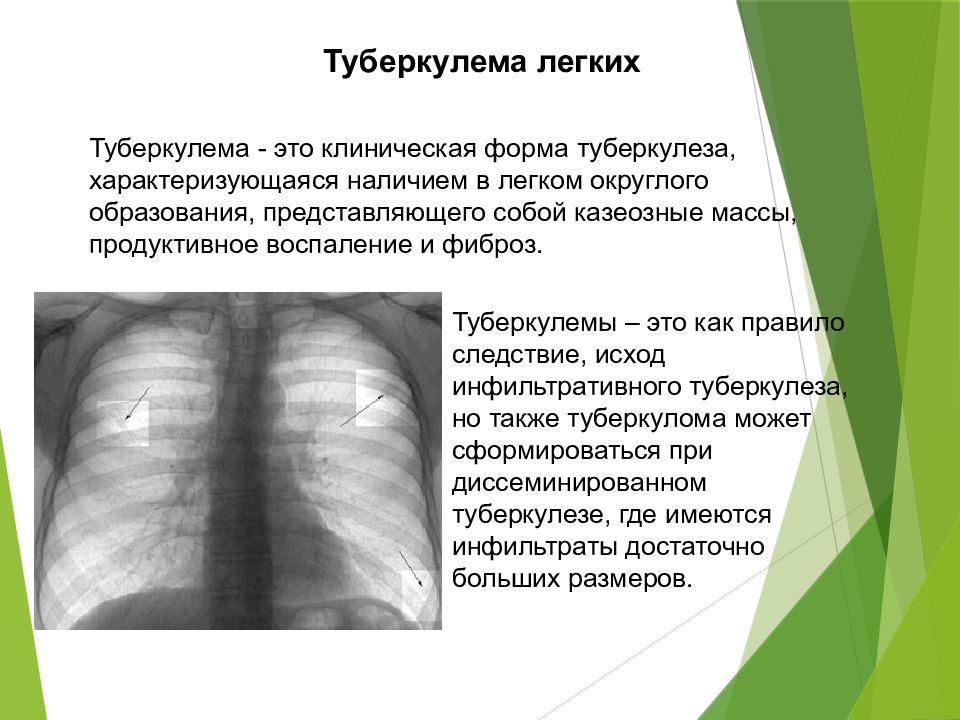 Лекция№24 Лечения Туберкулеза у детей