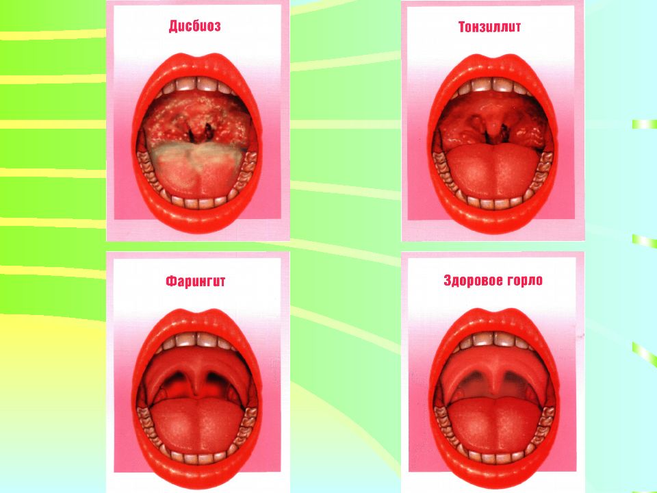 Анатомо-физиологические особенности и семиотика поражения полости рта,