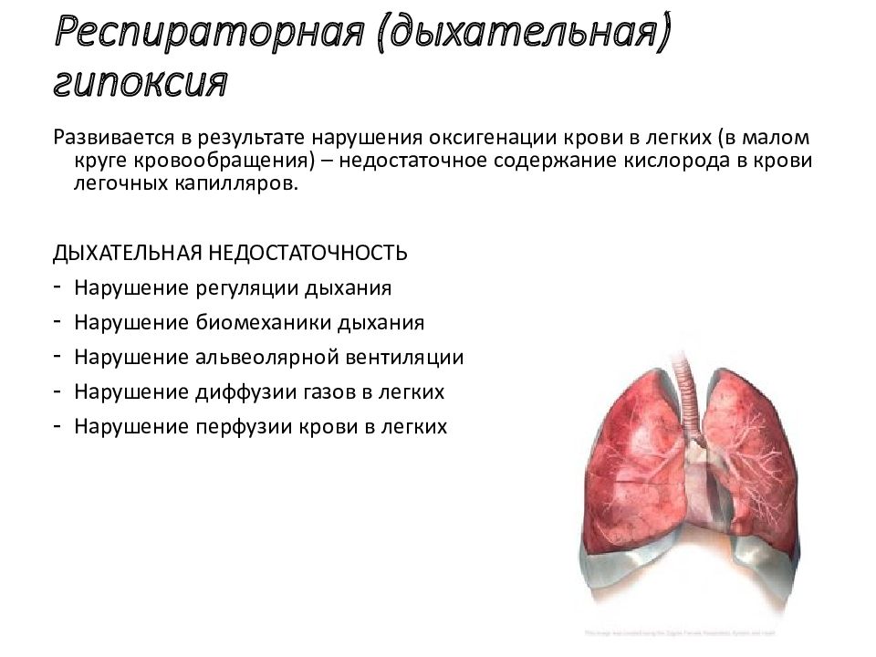 Респираторная (дыхательная) гипоксия