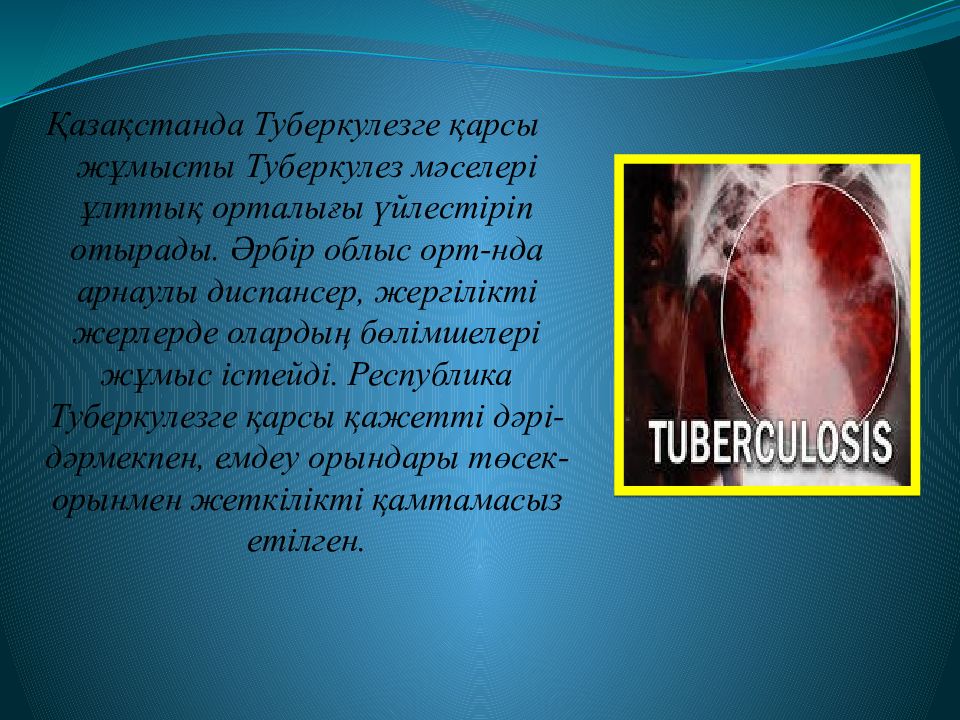 Туберкулезд ің алдын алу