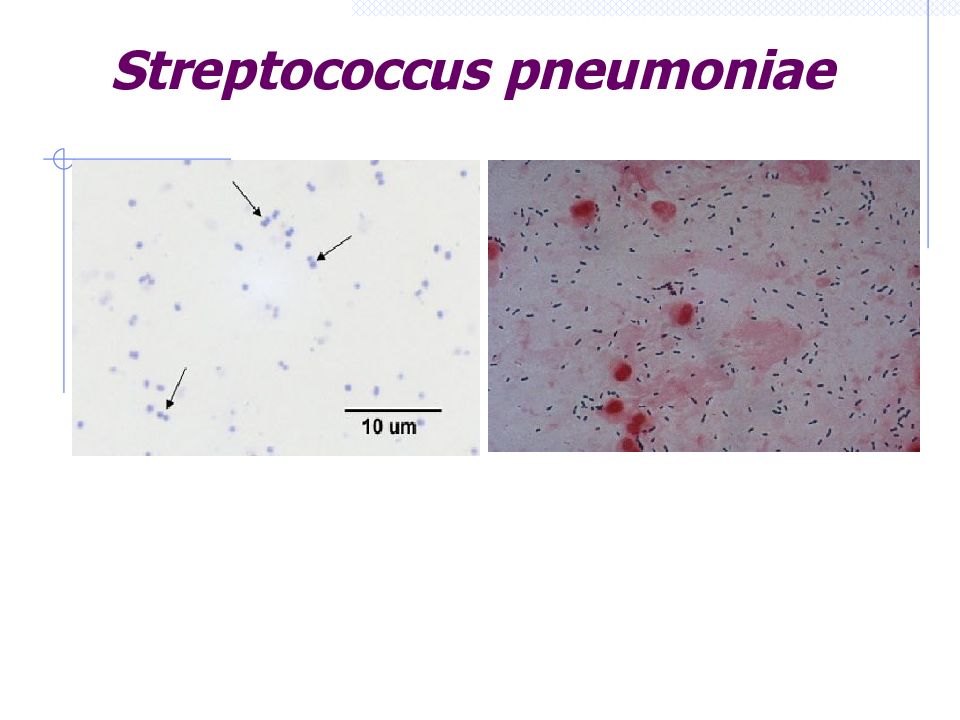 Streptococcus pneumoniae. 