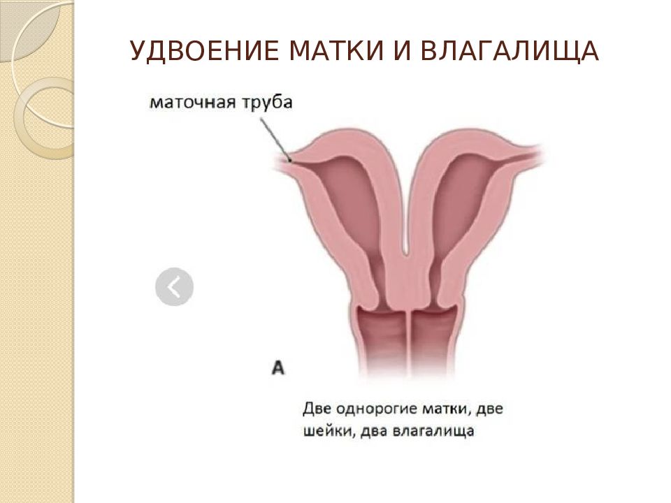 2 vaginas