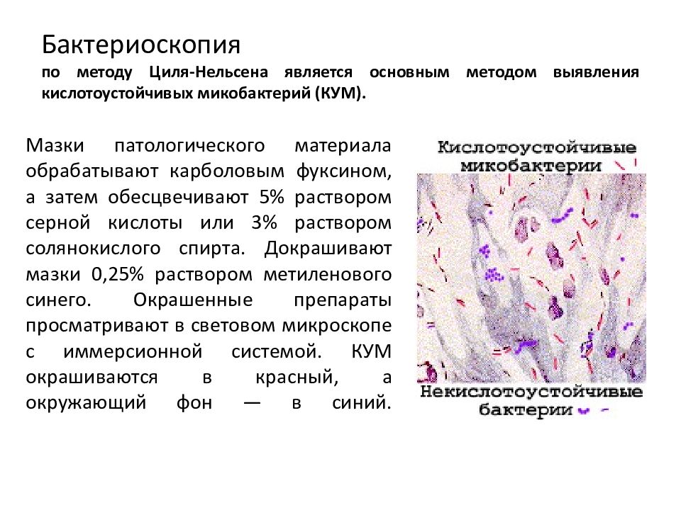 Бактериоскопия по методу Циля-Нельсена является основным методом выявления кислотоустойчивых микобактерий (КУМ ).