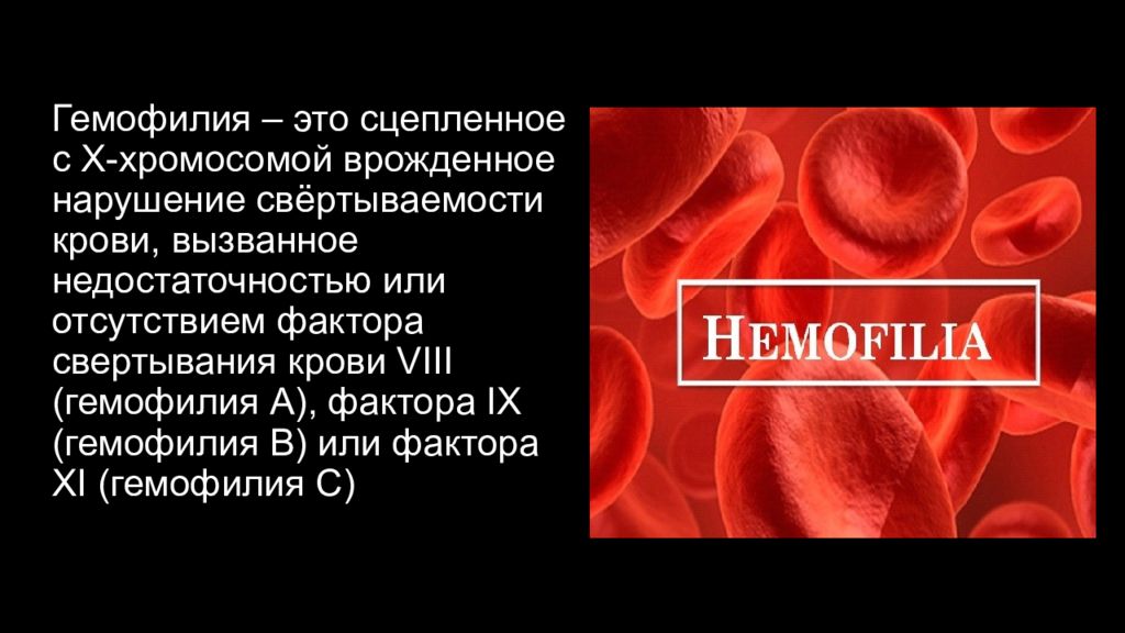 Гемофилия – это сцепленное с Х-хромосомой врожденное нарушение свёртываемости крови, вызванное недостаточностью или отсутствием фактора свертывания крови VIII