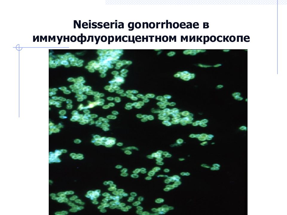 Neisseria gonorrhoeae в иммунофлуорисцентном микроскопе